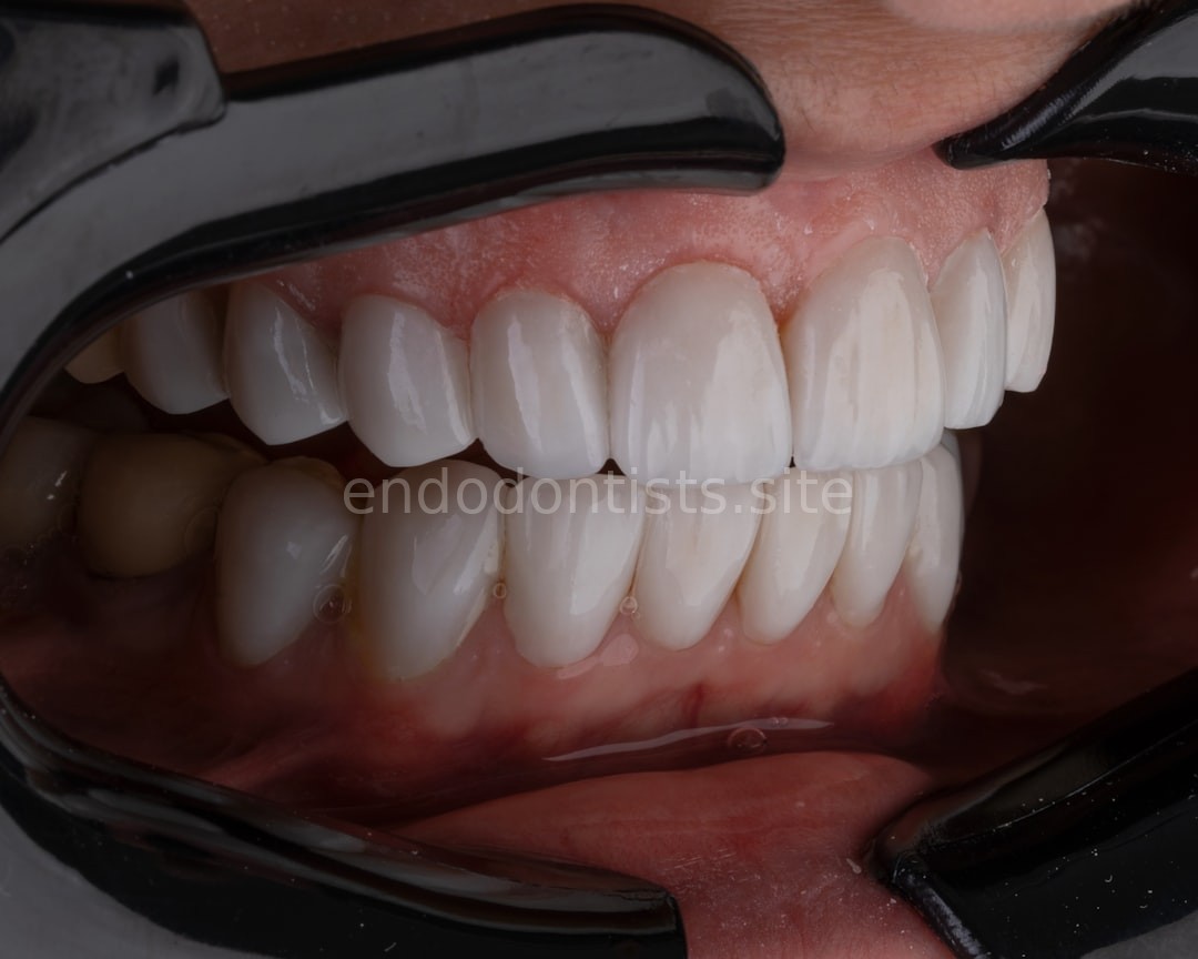 Dentist working